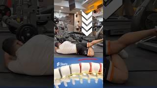 کمردرد #viral #sciatica #sciaticanervepain #anatomy