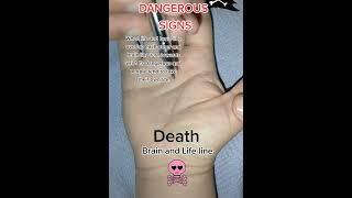 Dangerous signs on hand#palmist #palmistry #palmistry001