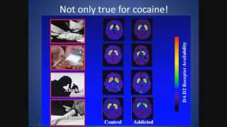 Biology of Addiction