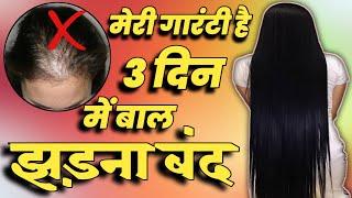 Hair loss front of head female | Ranu patel