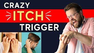 Got Itchy Skin Without Rash? (The SHOCKING Neuropathic Itch Trigger Explained) | Dr. Shawn Kwatra