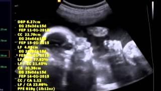 STEFANY ALEJANDRA - SUS PRIMEROS GESTOS