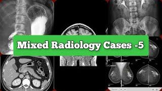 Radiology Viva Cases # 48-70 | Mixed Cases & Rapid Reporting | Auntminnie Type #medical #radiology