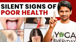 15 Signs of UNHEALTHINESS in Human Body(Don’t miss 10th!) | Saurabh Bothra Yoga