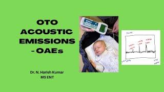 OTO ACOUSTIC EMISSIONS | MBBS - ENT