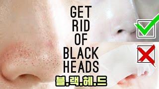 How To Get Rid of Blackheads Without a Nose Strip : Blackhead Removal Mask