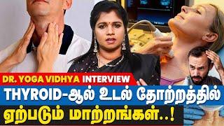 Thyroid இருந்தால் பெண்களுக்கு அதிகமா பிரச்சனைகள் ஏற்படும் | Dr.Yoga Vidhya Interview |T3, T4 and TSH