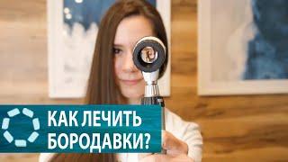 Как лечить бородавки?