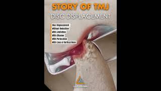 Story Of TMJ