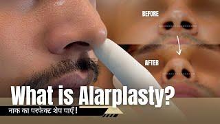 Get a Slimmer Nose with Alarplasty by Dr. Adarsh Tripathi | Sarayu Clinics #nosereshaping