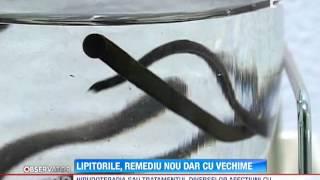 Terapia cu lipitori, cea mai nouă metodă de tratament