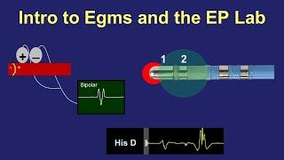 Intro to Intra-cardiac Electrograms & the EP Lab