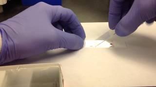 Hematology- Making a Peripheral Blood Smear