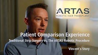 Patient Comparison of Strip Hair Restoration with ARTAS Robotic Hair Transplant Florida