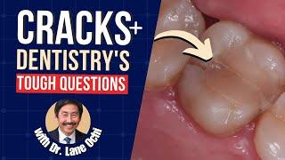 Cracked Teeth and Dentistry's Tough Questions with Dr Lane Ochi - PDP175