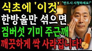 식초에 '이것' 한방울 섞으면 검버섯·기미·주근깨 2주만에 싹 없어집니다! 의사가 추천하는 진짜 효과 있는 검버섯·기미·주근깨 주름 없애는 가장 저렴한 관리 방법!