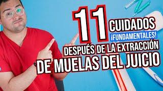 11 CUIDADOS DESPUÉS de una EXTRACCIÓN de MUELAS DEL JUICIO en 2020