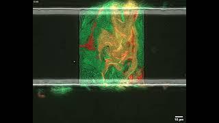 Live-cell imaging of horizontal gene transfer between E. coli in a microfluidic device