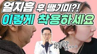#땡기미효과 #얼굴지방흡입붓기 #성형후땡기미 땡기미 언제까지 해야 할까요?