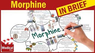 Morphine (Maracex, Oramorph, Sendolor): What is Morphine Used For, Uses, Dosage & Side effects