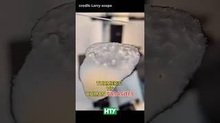 Turmeric vs. Parasitic Worms - You Won’t Believe This 🫚