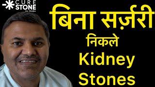 बिना ऑपरेशन किडनी स्टोन निकाला | Without surgery kidney stone removed - Dr. Deepanshu Gupta