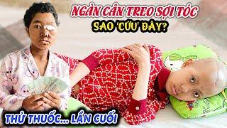  NỮ SINH BỎ HỌC ‘CẮT… BỎ’ KHUÔN MẶT CHỜ TOA THUỐC ‘ĐỊNH MỆNH’ CUỐI. BÉ 15T 2 BỆNH LẠ ‘NGUY’ RỒI!