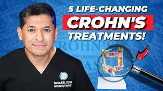 Crohn’s Disease Treatments You’ve Never Heard Of (But Should!)