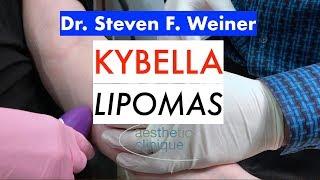 Kybella treating Lipomas done by Dr. Steven F. Weiner