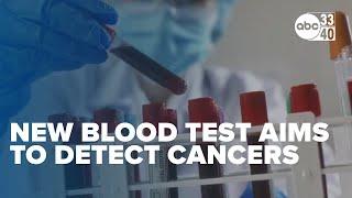 Is it accurate?: New blood test aims to detect multiple cancers before symptoms arise