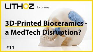 Lithoz Explains #11: 3D-Printed Bioceramics - a MedTech Disruption?