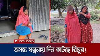 স্বাভাবিক জীবনে ফেরার আকুতি নেত্রকোণার রিমুর | Netrokona | Rimu | Jamuna TV