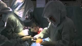 Operation eines patientenindividuellen Knieimplantat-Systems iTotal® G2