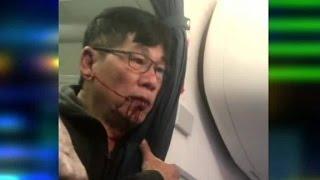 New video shows United passenger bleeding after incident