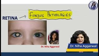 Fundus Images of Retina || Dr. Niha Aggarwal