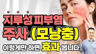 지루성피부염과 주사, 모낭충이 함께 있다면 어떻게 해야할까요? 진단부터 치료까지 정확히 알아야 합니다