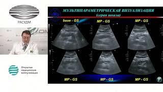Мультипараметрическое трансабдоминальное УЗИ поджелудочной железы при опухолевых поражениях