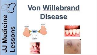 Von Willebrand Disease | Pathophysiology, Types, Symptoms and Treatment