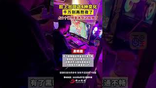 脸上出现这4种变化，千万别再熬夜了，占2个说明身体到达极限了！（编辑：梁铭鼎；责编：崔锦玥；素材来源：健康时报）#社会百态  #熬夜  #健康