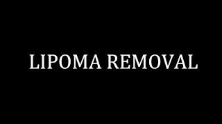 LIPOMA REMOVAL