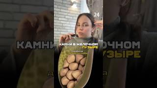 Камни в желчном пузыре #здоровье #нутрициолог #правильноепитание
