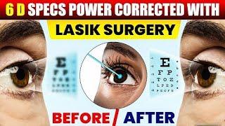 -6 D Specs Power Corrected with LASIK Surgery | Vision Eye Centre #lasik #doctor