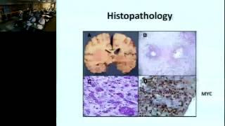 UAMS Neurology Grand Rounds 092614