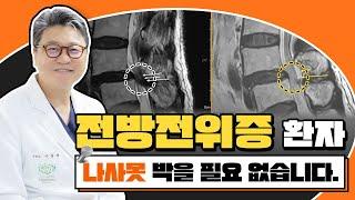 척추전방전위증 나사못고정술 받지 않아도 치료 됩니다｜참포도나무병원 이동엽 원장