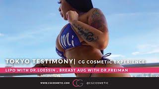 TOKYO Panda Testimony at CG Cosmetic Surgery | Liposuction by Dr.Loessin and BAM by Dr.Freiman