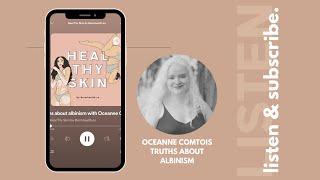 Truths about albinism with Oceanne Comtois