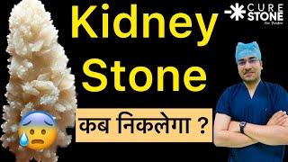 Kidney Stones कब निकलेगा ?| Can Kidney Stones be removed Naturally - Dr  Deepanshu Gupta | Curestone