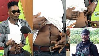 Sad momentActor Scorpion shows his surgèry stomach after been sh0t in his room