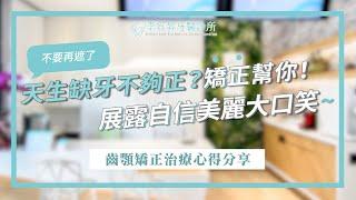 不要再遮了~天生缺牙不夠正？矯正幫你！展露自信美麗大口笑齒顎矯正治療心得分享．王小姐｜李宜昇牙醫診所 /台中植牙推薦/台中矯正推薦 /台中牙醫推薦