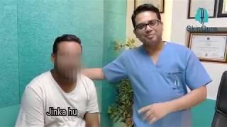 Best Hair line design in Hair Transplant @SkinQure Clinic by Dr Jangid